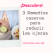 bolsas en los ojos tratamientos caseros